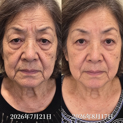 ✨ 今なら𝟓𝟎%𝐎𝐅𝐅｜𝐇𝐞𝐚𝐥𝐫𝐢𝐳𝐞® ✅ 𝐏𝐃𝐑𝐍 エイジングケア スポット美容スティック｜乾燥による小ジワ・ハリ不足・気になるスポットを集中ケア👩‍⚕️