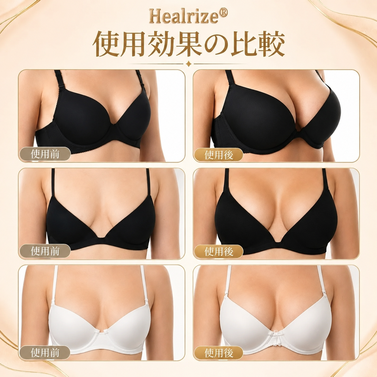 Healrize® ナノマイクロニードル バストリフトパッチ ✨｜手術不要・貼るだけでハリとふっくら感のある上向きバストラインをサポートし、女性らしい自信を取り戻すバストケアパッチ 💖