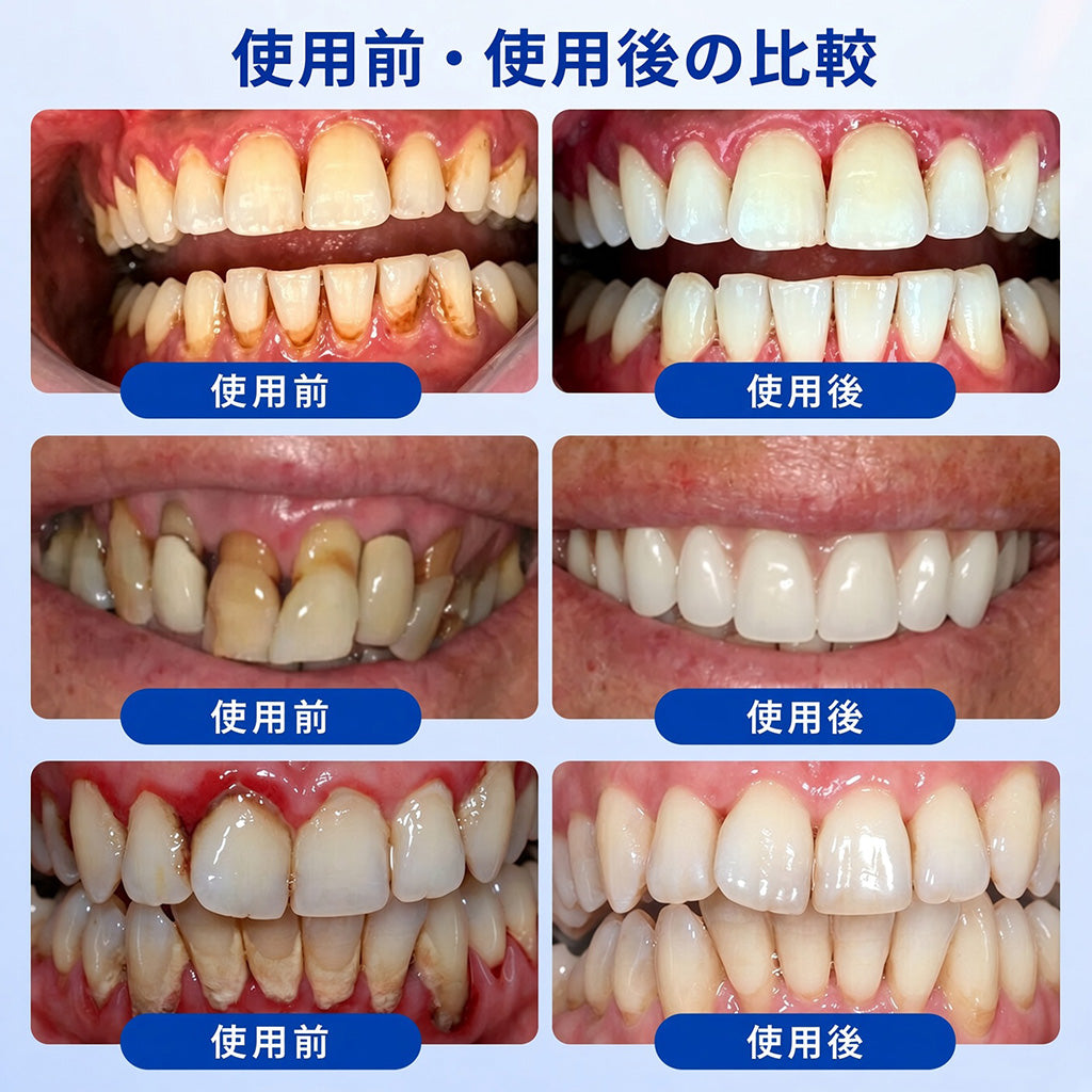 🔥今なら𝟓𝟎%𝐎𝐅𝐅｜𝐓𝐫𝐢𝐥𝐮𝐦𝐢𝐚® 𝐆𝐮𝐦𝐑𝐞𝐯𝐢𝐯𝐞 🦷 歯ぐき・歯周ケアのための集中ケアジェル✨