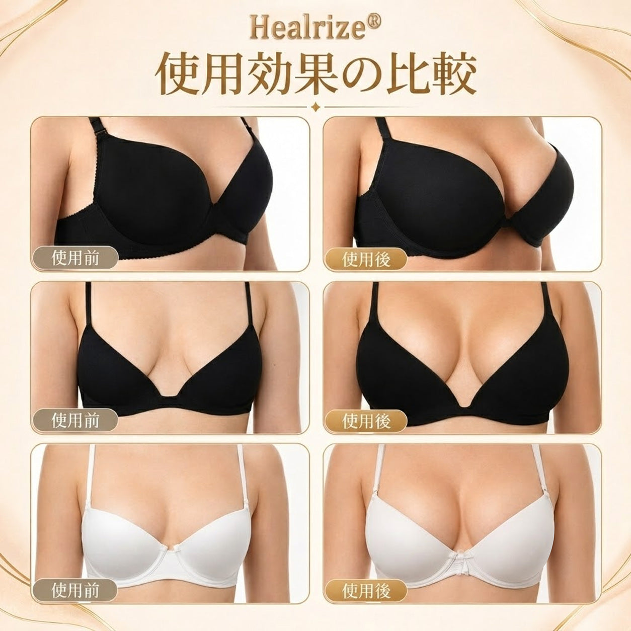 Healrize® ナノマイクロニードル バストリフトパッチ ✨｜手術不要・貼るだけでハリとふっくら感のある上向きバストラインをサポートし、女性らしい自信を取り戻すバストケアパッチ 💖