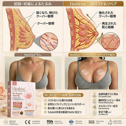 Healrize® ナノマイクロニードル バストリフトパッチ ✨｜手術不要・貼るだけでハリとふっくら感のある上向きバストラインをサポートし、女性らしい自信を取り戻すバストケアパッチ 💖