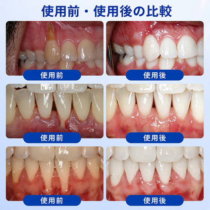 🔥今なら𝟓𝟎%𝐎𝐅𝐅｜𝐓𝐫𝐢𝐥𝐮𝐦𝐢𝐚® 𝐆𝐮𝐦𝐑𝐞𝐯𝐢𝐯𝐞 🦷 歯ぐき・歯周ケアのための集中ケアジェル✨