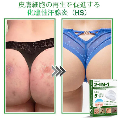 💆‍♀️本日限定80%OFF 🔥 Hudros® 2in1 マイクロニードル＆ハイドロコロイドパッチ｜ニキビ・肌荒れ・肌悩みを集中ケア｜目立ちにくい星型パッチ｜顔・ボディ用｜144枚入り
