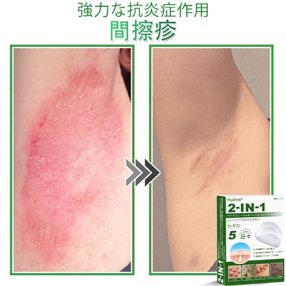 💆‍♀️本日限定80%OFF 🔥 Hudros® 2in1 マイクロニードル＆ハイドロコロイドパッチ｜ニキビ・肌荒れ・肌悩みを集中ケア｜目立ちにくい星型パッチ｜顔・ボディ用｜144枚入り