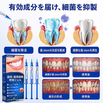 🔥今なら𝟓𝟎%𝐎𝐅𝐅｜𝐓𝐫𝐢𝐥𝐮𝐦𝐢𝐚® 𝐆𝐮𝐦𝐑𝐞𝐯𝐢𝐯𝐞 🦷 歯ぐき・歯周ケアのための集中ケアジェル✨