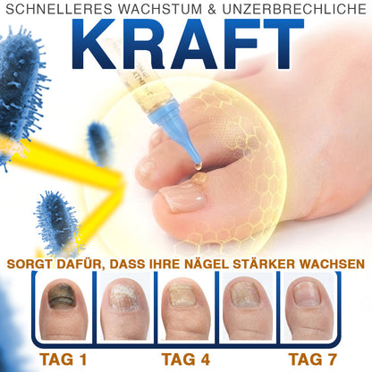 🇩🇪 CareBreeze® Fungi Free Bienengift-Nagelbehandlung 🥼