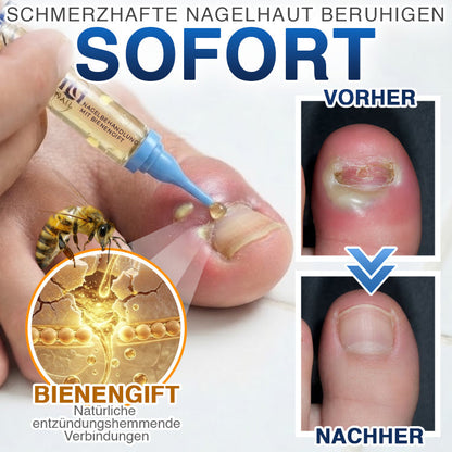 🇩🇪 CareBreeze® Fungi Free Bienengift-Nagelbehandlung 🥼