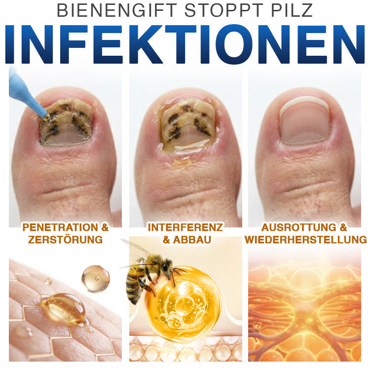 🇩🇪 CareBreeze® Fungi Free Bienengift-Nagelbehandlung 🥼