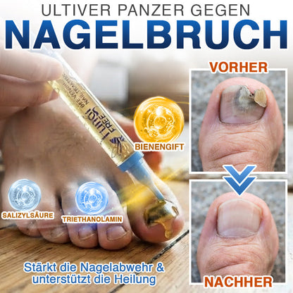 🇩🇪 CareBreeze® Fungi Free Bienengift-Nagelbehandlung 🥼