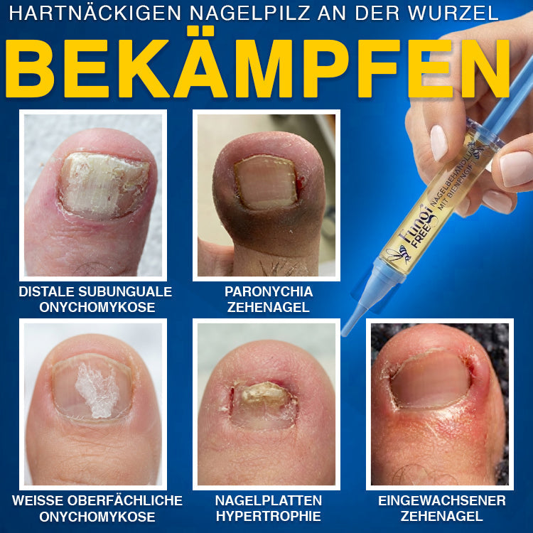 🇩🇪 CareBreeze® Fungi Free Bienengift-Nagelbehandlung 🥼