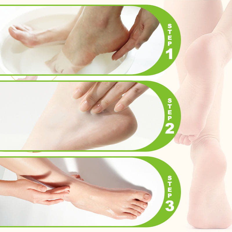 Hudros ® Hydrating and Anti-Cracking Foot Cream